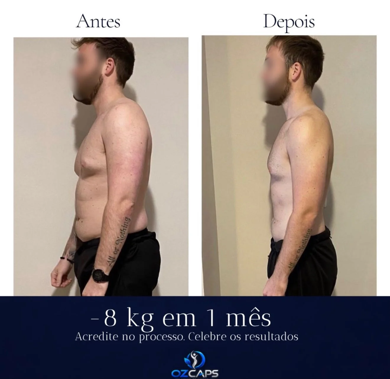 Antes e depois de cliente OzCaps com -8 kg