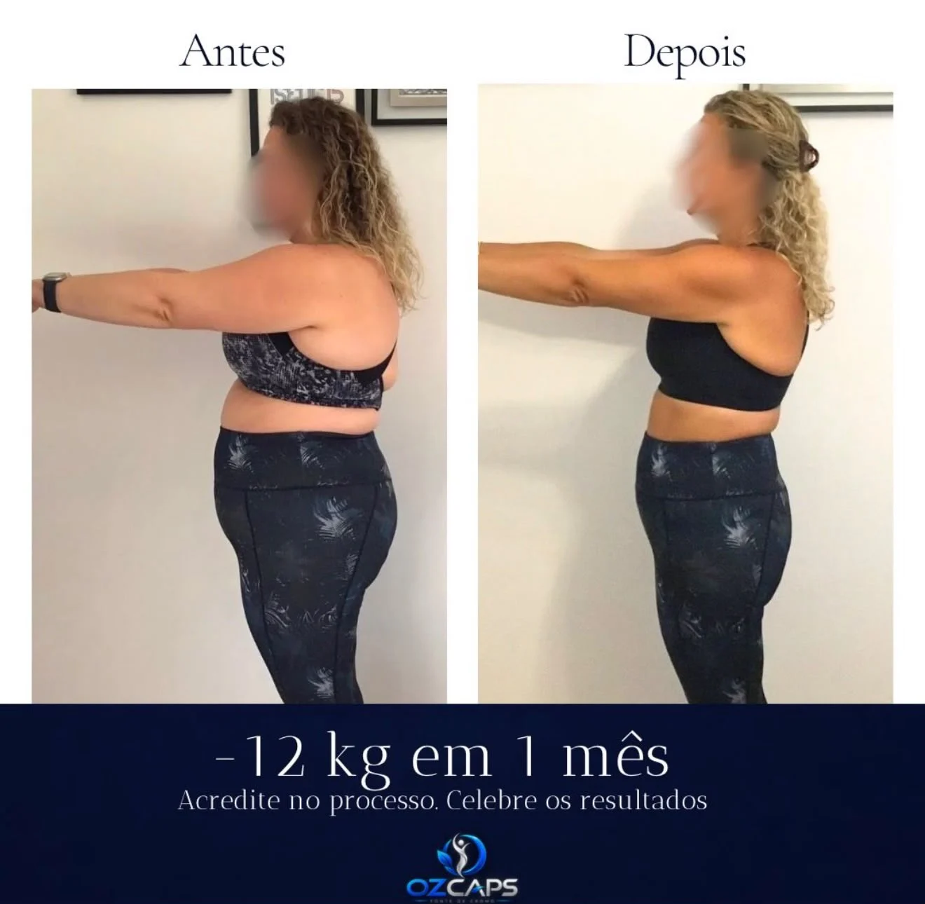 Antes e depois de cliente OzCaps com -12 kg